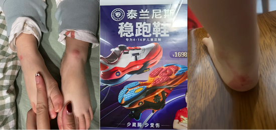 千元童鞋把脚穿肿?泰兰尼斯遭家长“围攻”,医生警惕影响发育,90%专利竟是外观设计 第1张 千元童鞋把脚穿肿?泰兰尼斯遭家长“围攻”,医生警惕影响发育,90%专利竟是外观设计 第1张